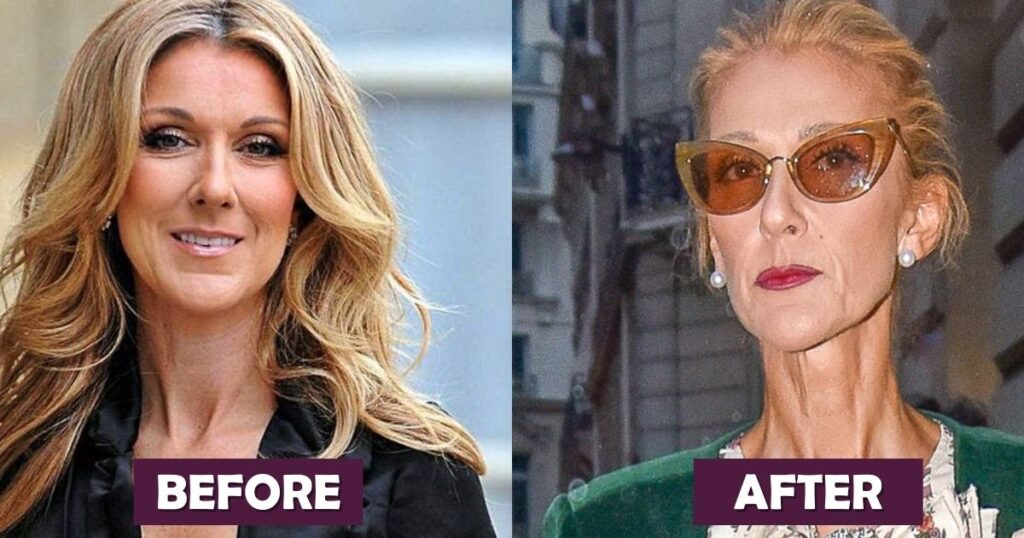 Celine Dion Weight Loss Journey: Diet, Exercise, Before & After Photos