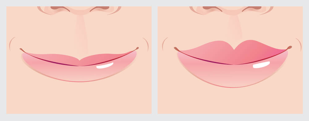 6 Ways to Even Out Uneven Lips